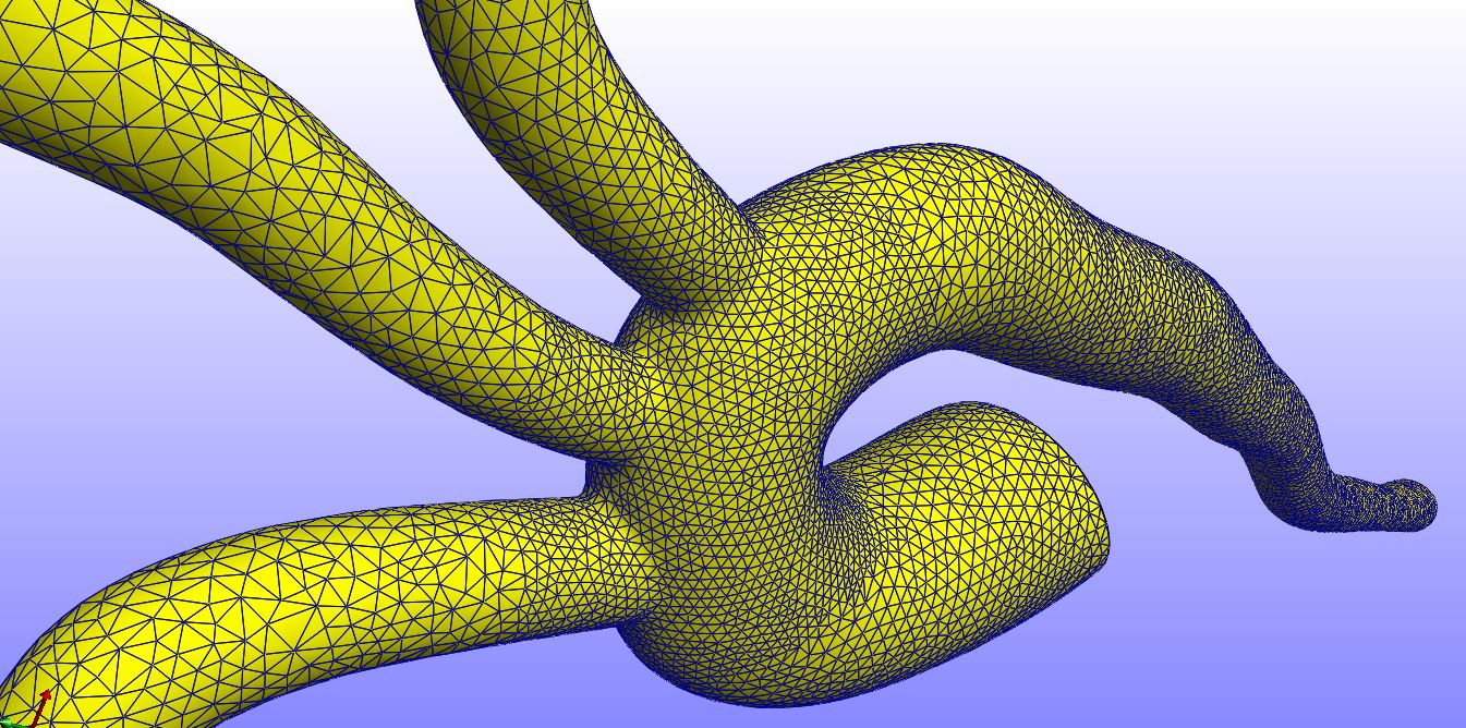 Aorta FEA simulation
